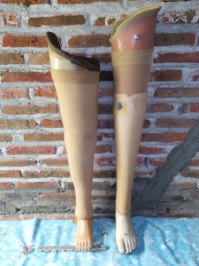prosthesis kaki palsu atas lutut